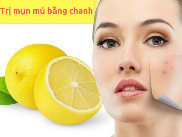 Cách điều trị mụn mủ bằng chanh