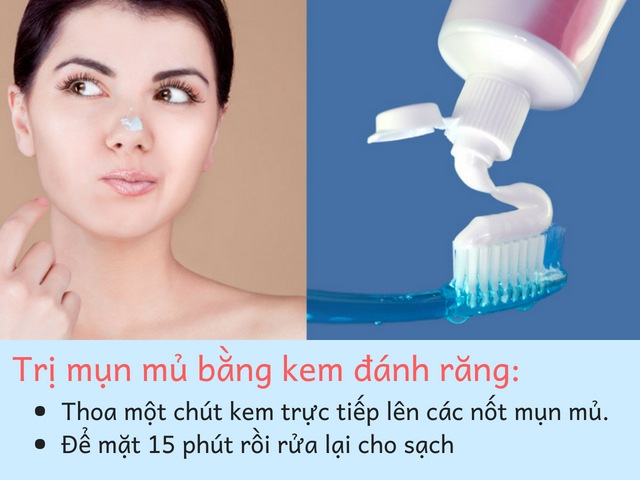 Cách trị mụn mủ nhanh nhất bằng kem đánh răng