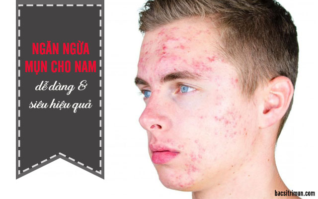 Cách ngăn ngừa mụn cho nam