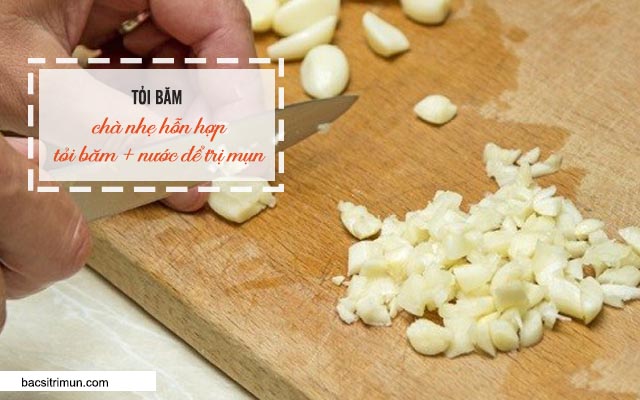 cách trị mụn bằng tỏi băm