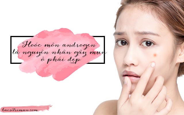 Tăng hoóc môn androgen là nguyên nhân mọc mụn