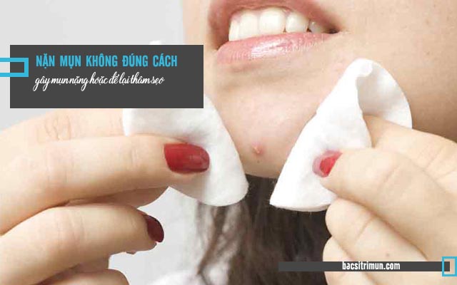 sự thật về mụn trứng cá - nặn mụn không giúp hết mụn