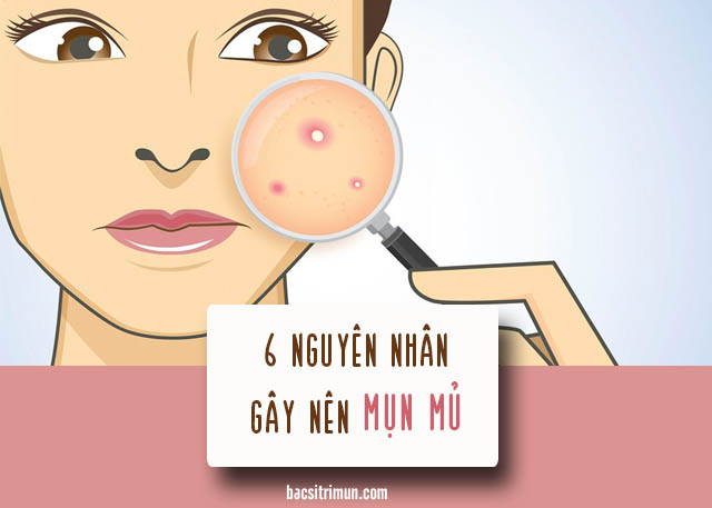 nguyên nhân gây mụn mủ