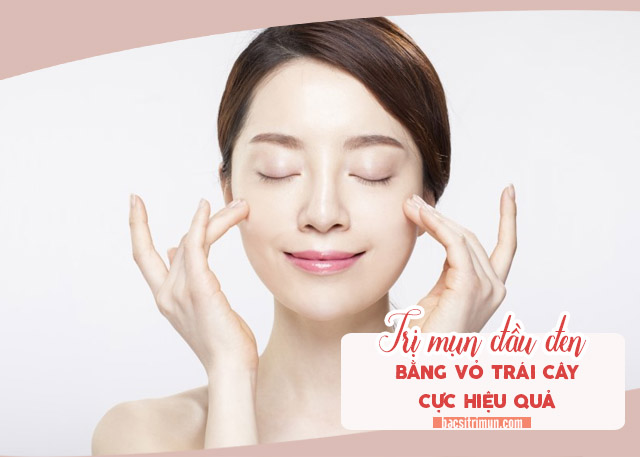 trị mụn đầu đen