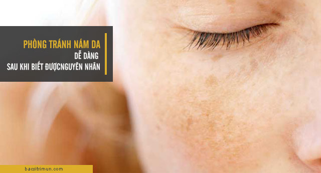 nguyên nhân gây nám da và cách phòng tránh