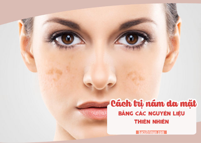 cách trị nám da mặt tự nhiên