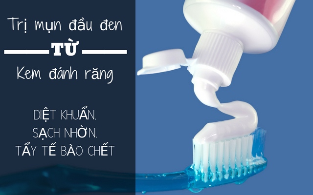 Trị mụn đầu đen bằng kem đánh răng