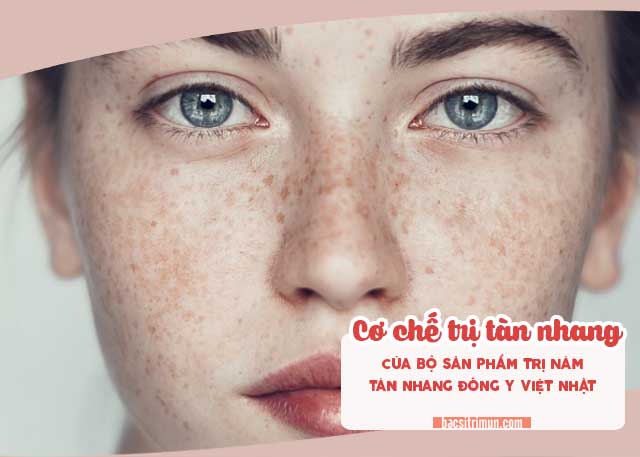 Bộ trị nám tàn nhang đông y Việt - Nhật