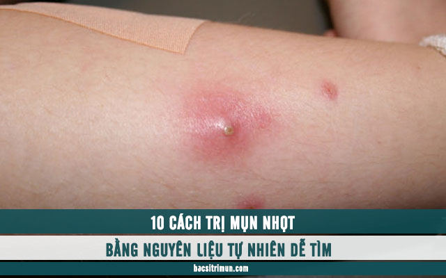 cách trị mụn nhọt