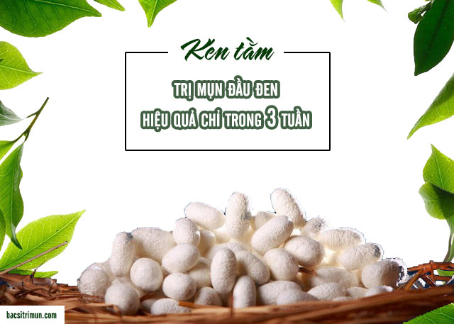 kén tằm trị mụn