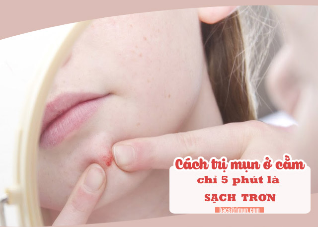 cách trị mụn ở cằm