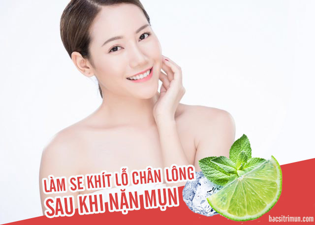 se khít lỗ chân lông sau khi nặn mụn