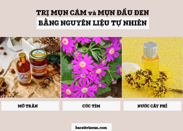 trị mụn cám và mụn đầu đen bằng mỡ trăn, cúc tím và nước cây phỉ