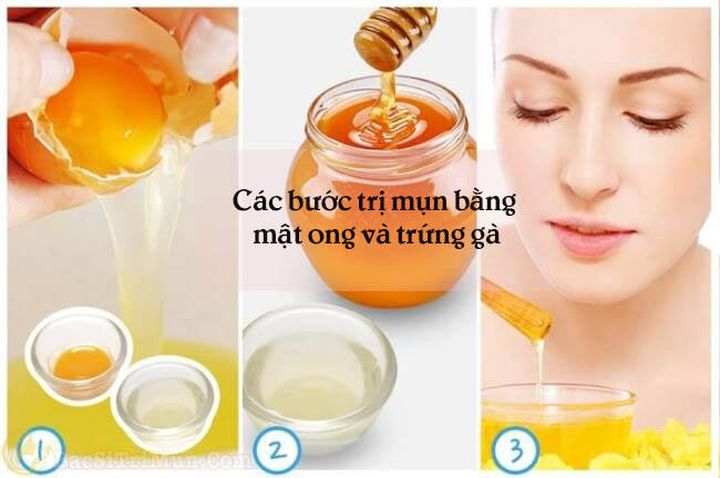 Trứng gà và mật ong là một trong các loại mặt nạ trị mụn hiệu quả