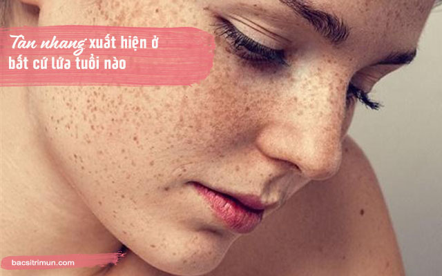 phân biệt tàn nhang đồi mồi dễ dàng