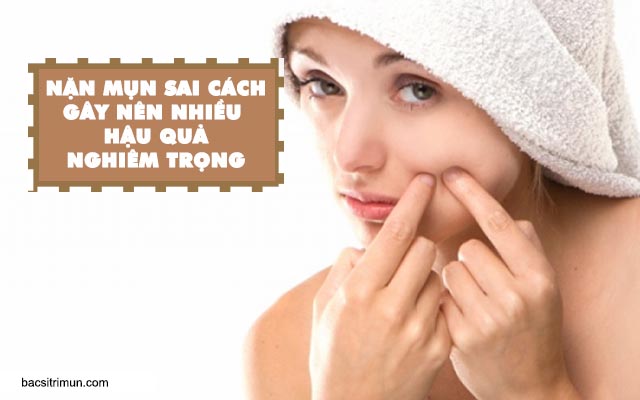 có nên nặn mụn đầu đen hay không? 