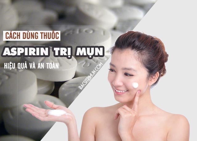 thuốc Aspirin trị mụn 