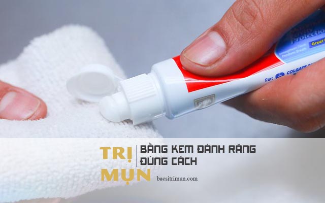 cách trị mụn bằng kem đánh răng