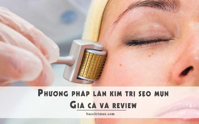 lăn kim trị sẹo mụn