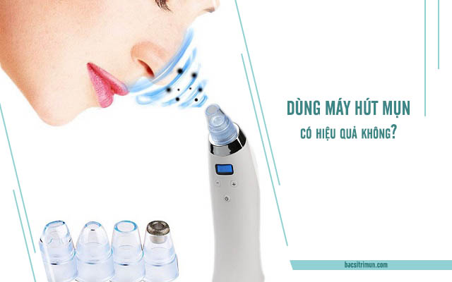 máy hút mụn có hiệu quả không