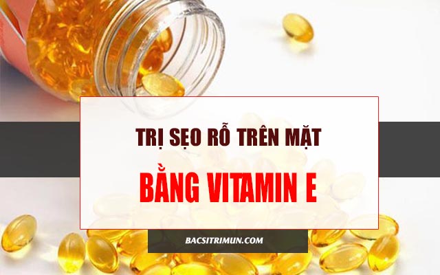 cách trị sẹo rỗ lâu năm trên mặt