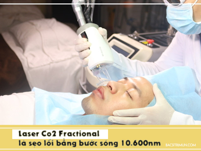 là sẹo lồi bằng Laser Co2 Fractional