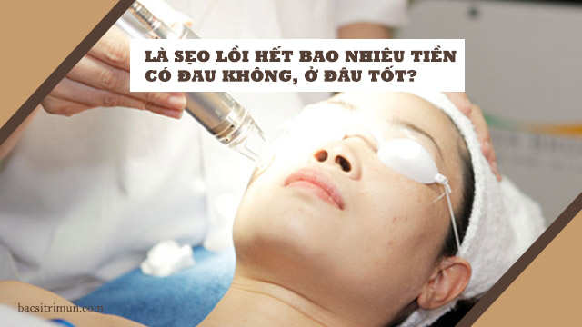 là sẹo lồi