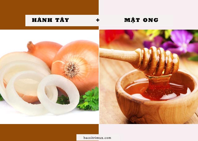 trị sẹo lồi bằng hành tây mật ong