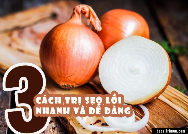 trị sẹo lồi bằng hành tây