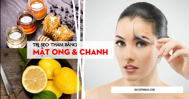 trị sẹo thâm bằng mật ong