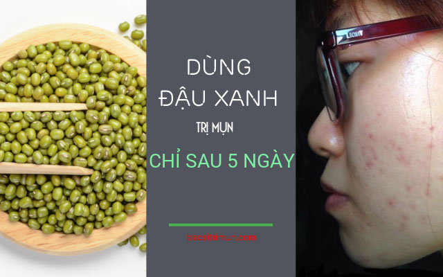 đậu xanh để trị mụn