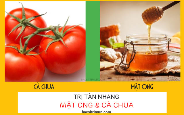 cách trị tàn nhang bằng mật ong