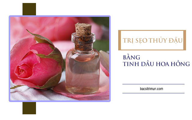 sẹo thủy đậu bao lâu thì hết