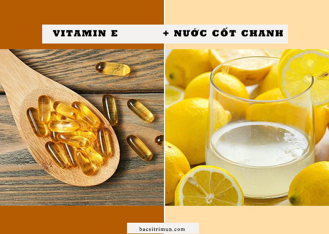 Cách trị sẹo rỗ bằng vitamin e và nước cốt chanh