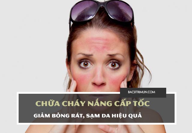 chữa cháy nắng