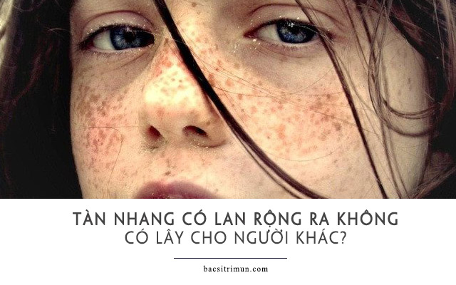 tàn nhang có lan ra không?