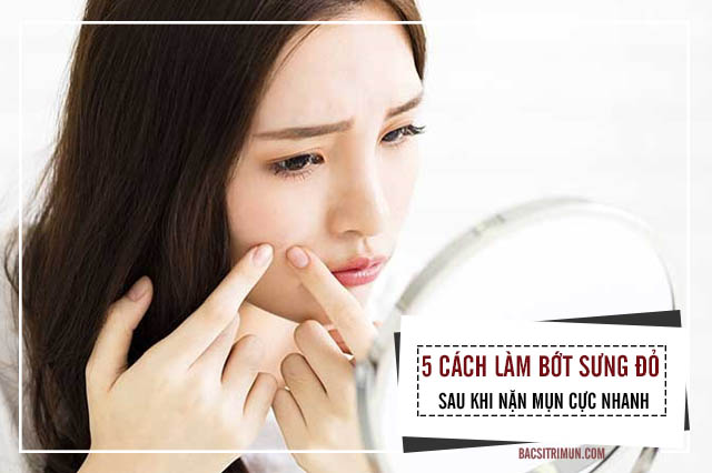 cách làm bớt sưng đỏ sau khi nặn mụn