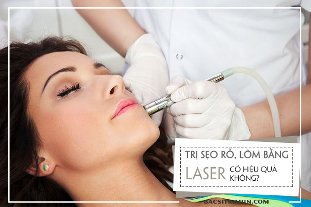 trị sẹo rỗ bằng laser