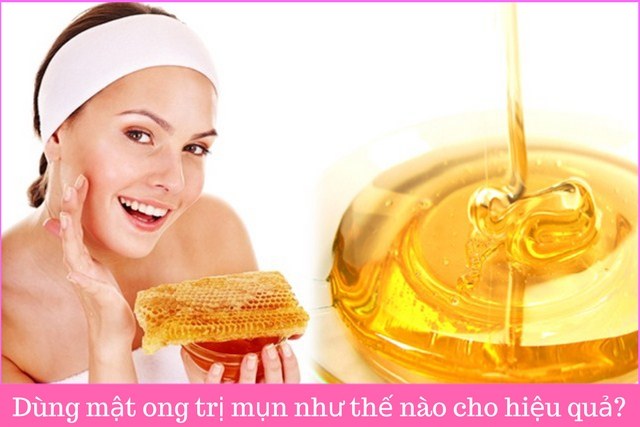 cách trị mụn bằng mật ong hiệu quả