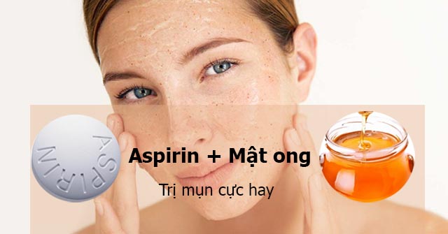 Mặt nạ Aspirin và mật ong trị mụn