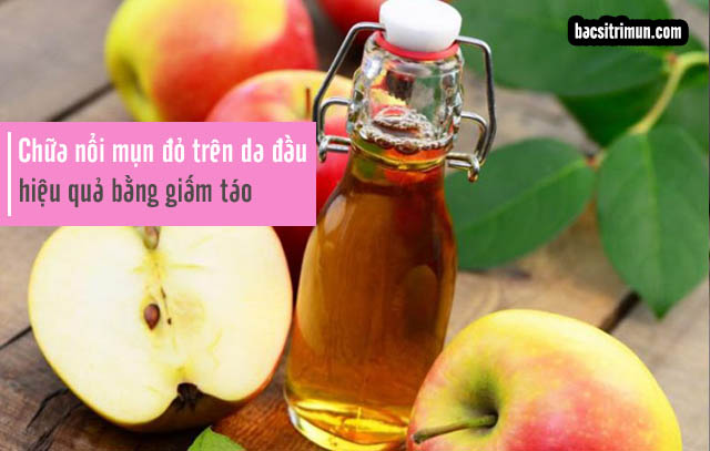 Giấm táo chữa da đầu nổi mụn đỏ