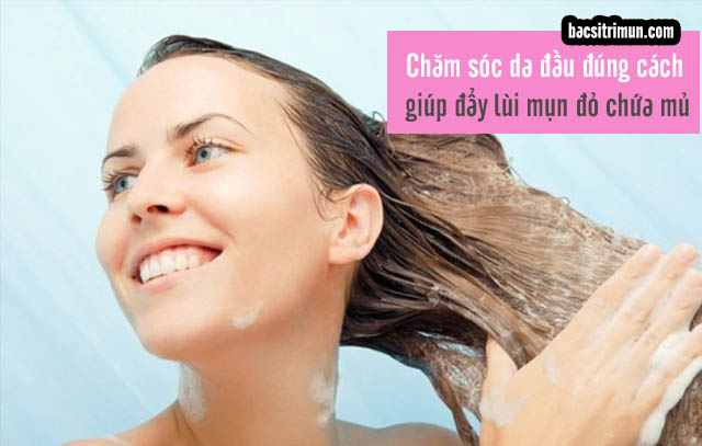 Da đầu nổi mụn đỏ chứa mủ cần được gội thường xuyên