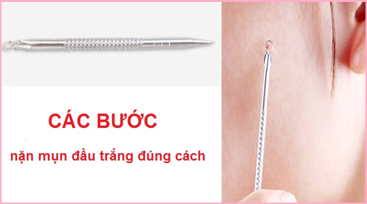 cách dùng cây nặn mụn đầu trắng