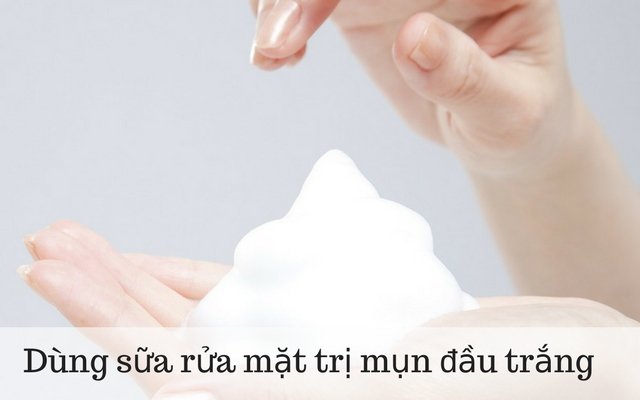 chữa mụn đầu trắng bằng sữa rửa mặt