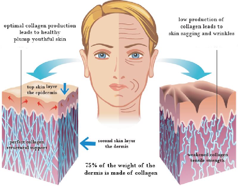 co-nen-uong-collagen-tri-mun-khong1