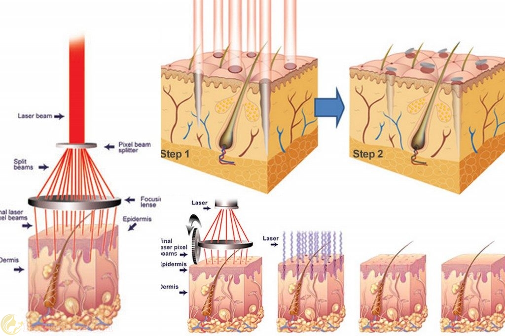 rối loạn nội tiết tố