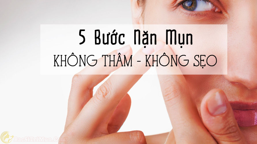 cách nặn mụn bằng cây nặn mụn an toàn