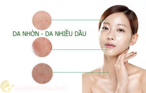 loại sữa rửa mặt trị mụn cho da nhờn