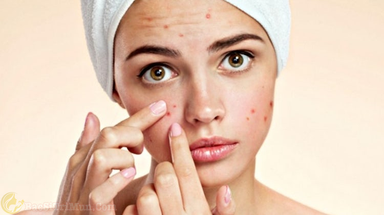 Mụn trứng cá là gì?