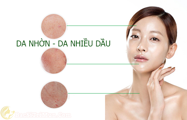 Sữa rửa mặt Cetaphil kiểm soát dầu nhờn trên bề mặt da